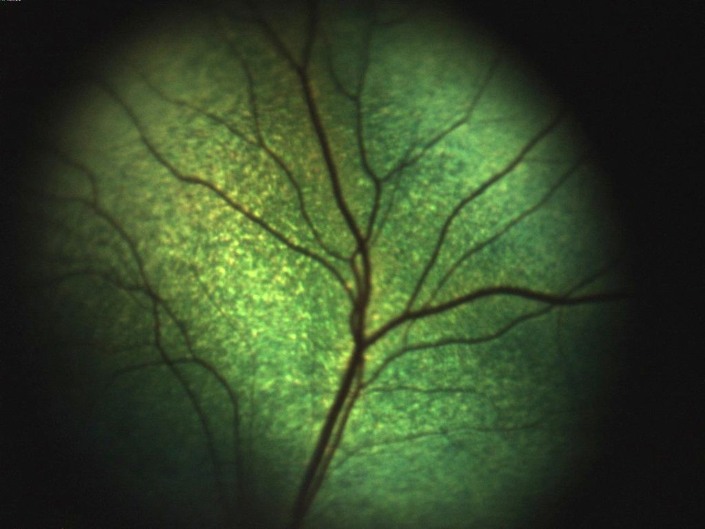 Retinal Imagery Epipole Veterinary 